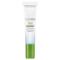 Normacne Acne Spot Treatment 